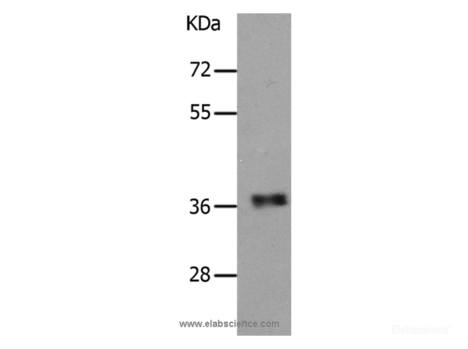 Western Blot analysis of Human fetal muscle tissue using PARD6A Polyclonal Antibody at dilution of 1:650