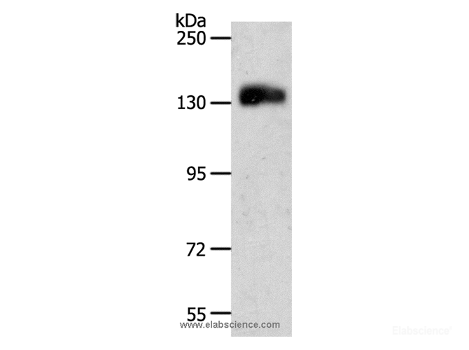 Western Blot analysis of Jurkat cell using CD31 Polyclonal Antibody at dilution of 1:500