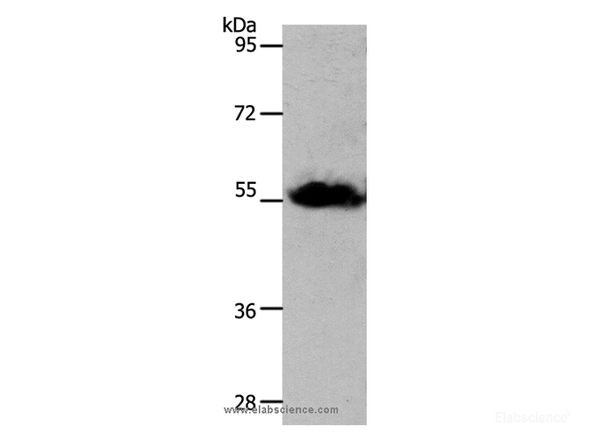 Western Blot analysis of Human liver cancer tissue using SLC1A4 Polyclonal Antibody at dilution of 1:1250