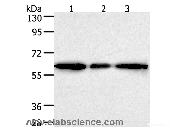Western Blot analysis of Human liver cancer tissue, hela and 293T cell using AKR1A1 Polyclonal Antibody at dilution of 1:500