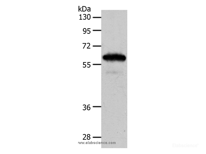 Western Blot analysis of Mouse brain tissue using INA Polyclonal Antibody at dilution of 1:550
