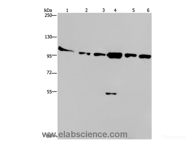 Western Blot analysis of Human testis tissue, K562, A549, Raji, NIH/3T3 and Hela cell using PRKD3 Polyclonal Antibody at dilution of 1:200