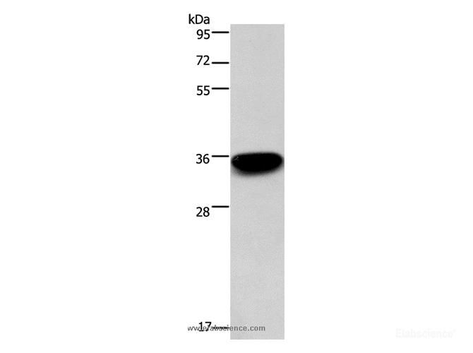 Western Blot analysis of 293T cell using PRPS1/2/PRPS1L1 Polyclonal Antibody at dilution of 1:400