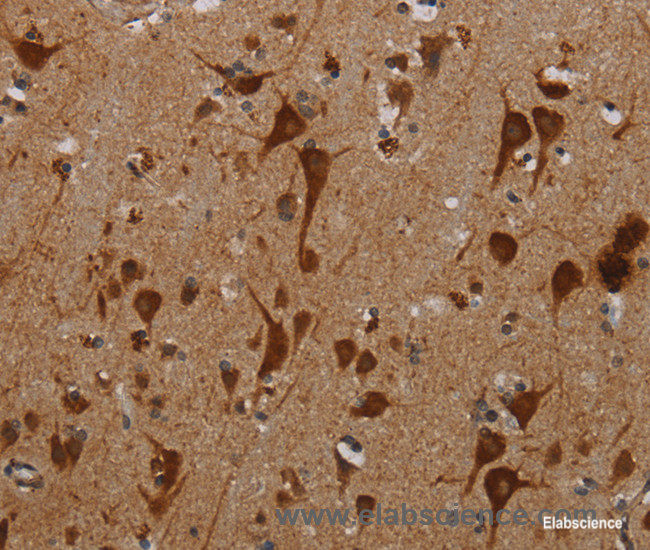 Immunohistochemistry of paraffin-embedded Human brain tissue using KMT2D Polyclonal Antibody at dilution 1:40