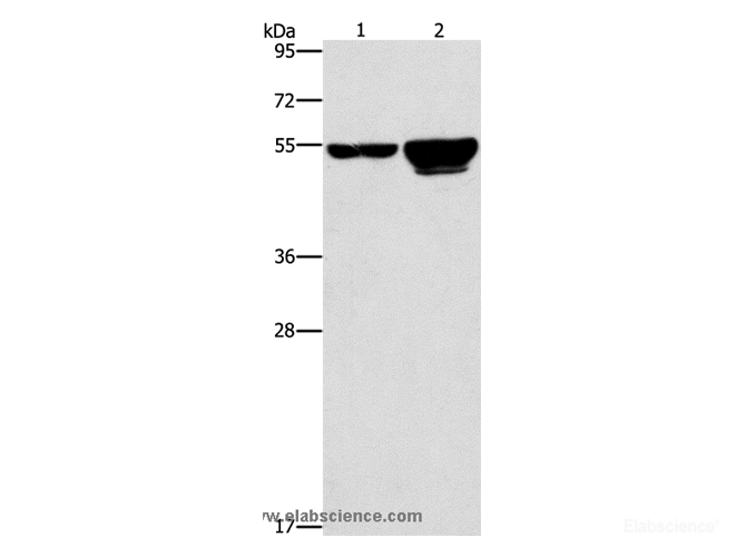 Western Blot analysis of 231 and A549 cell using CDC25A Polyclonal Antibody at dilution of 1:300