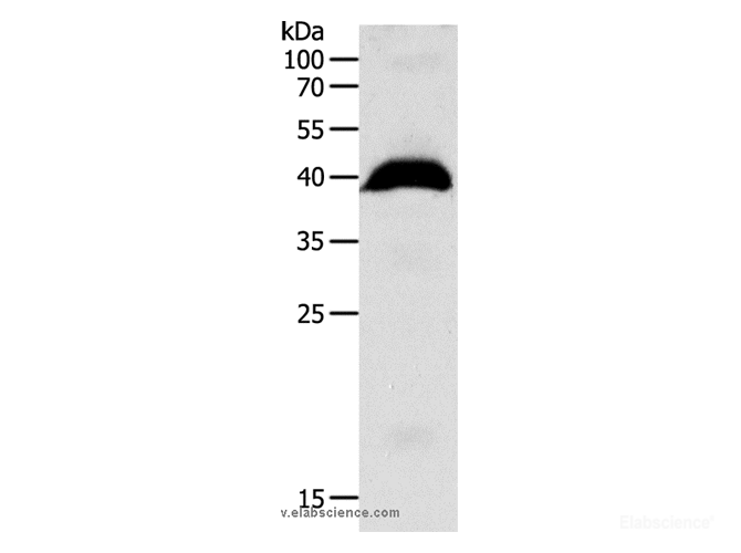 Western Blot analysis of Human liver cancer tissue using OPRL1 Polyclonal Antibody at dilution of 1:1100