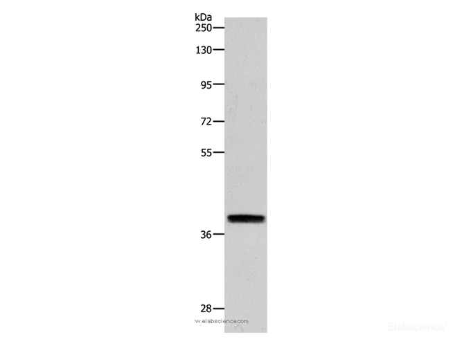 Western Blot analysis of RAW264.7 cell using RTN4 Polyclonal Antibody at dilution of 1:900