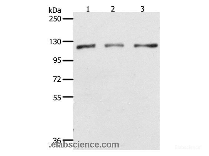 Western Blot analysis of Hela, K562 and Jurkat cell using PARP1 Polyclonal Antibody at dilution of 1:350