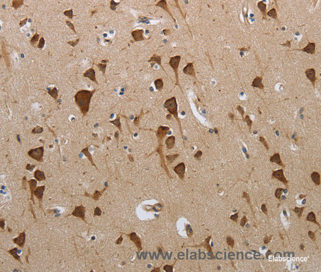 Immunohistochemistry of paraffin-embedded Human brain tissue using PMS2 Polyclonal Antibody at dilution 1:50