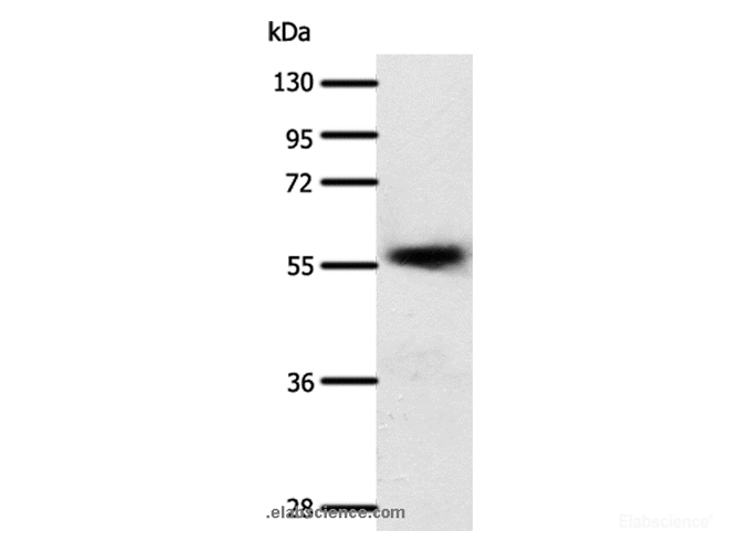 Western Blot analysis of Human esophagus cancer tissue using SLC22A17 Polyclonal Antibody at dilution of 1:600