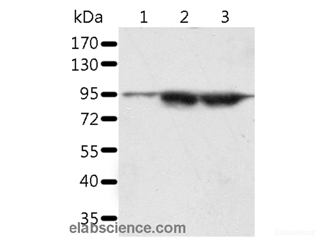 Western Blot analysis of A549 and lncap cell, Human seminoma tissue using SPATA20 Polyclonal Antibody at dilution of 1:1000