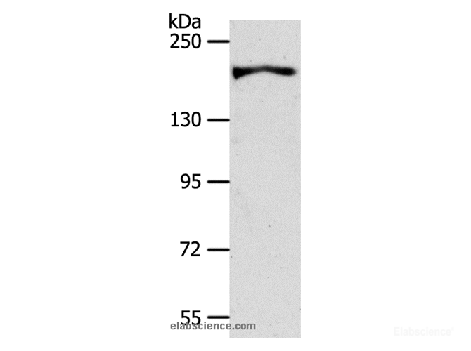 Western Blot analysis of HT-29 cell using AKAP12 Polyclonal Antibody at dilution of 1:600