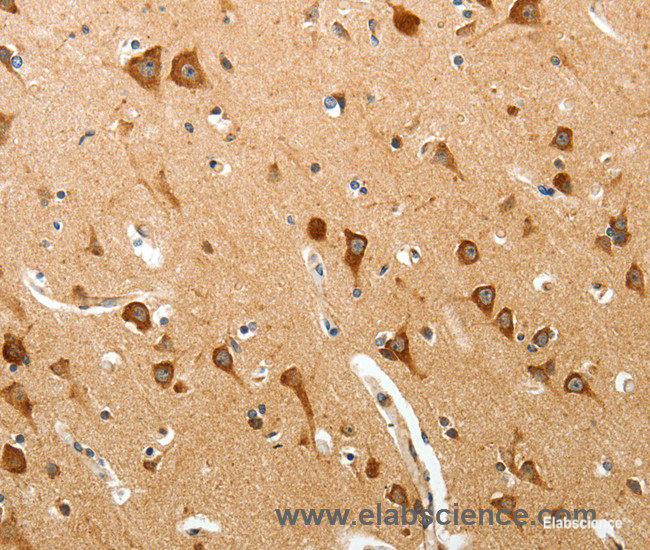 Immunohistochemistry of paraffin-embedded Human brain tissue using BIRC6 Polyclonal Antibody at dilution 1:40
