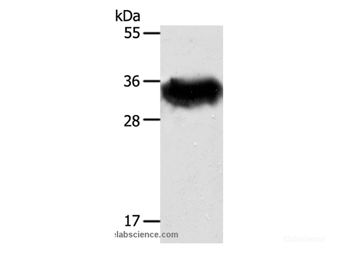 Western Blot analysis of Mouse brain tissue using STX1A Polyclonal Antibody at dilution of 1:600