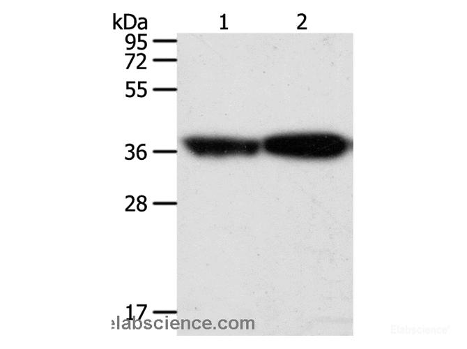 Western Blot analysis of Human leiomyosarcoma and Mouse testis tissue using TPM2 Polyclonal Antibody at dilution of 1:1000