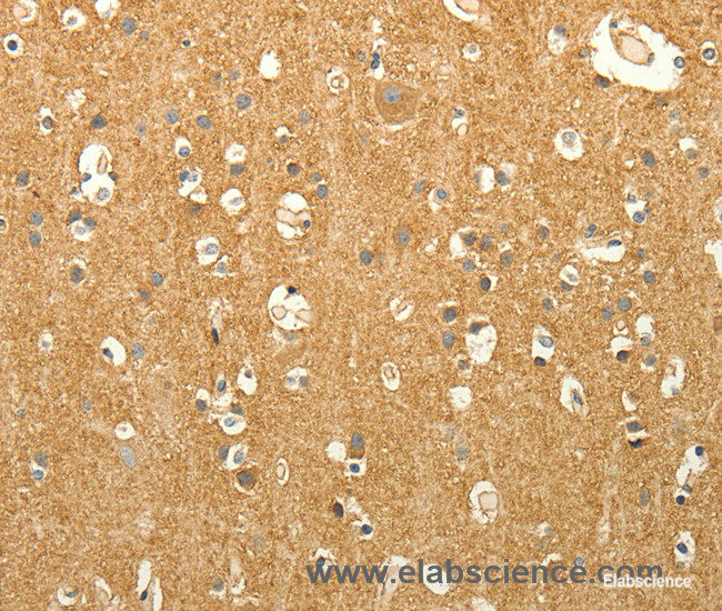 Immunohistochemistry of paraffin-embedded Human brain tissue using EDG7 Polyclonal Antibody at dilution 1:40