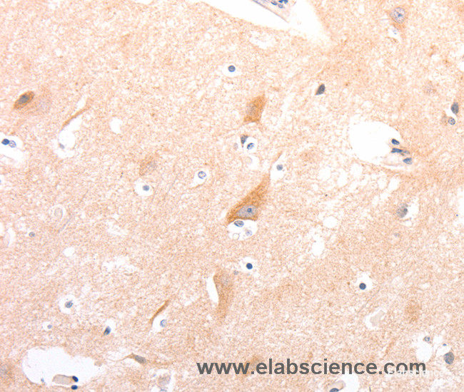 Immunohistochemistry of paraffin-embedded Human brain tissue using CELSR2 Polyclonal Antibody at dilution 1:50