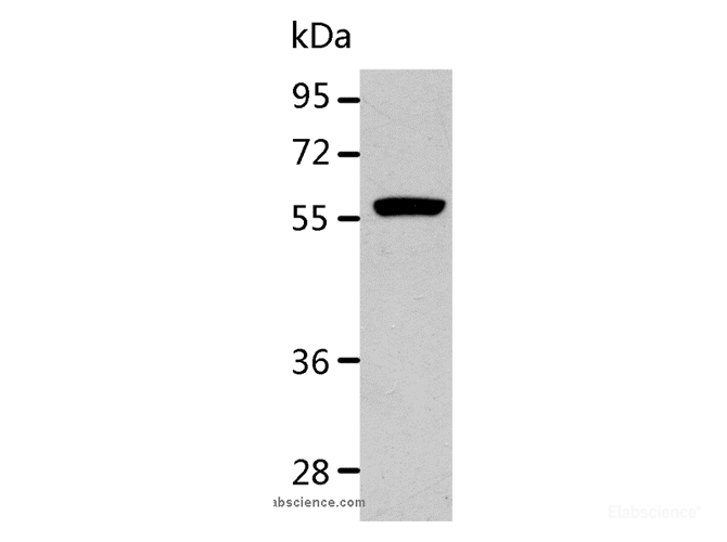 Western Blot analysis of K562 cell using ALDH1A2 Polyclonal Antibody at dilution of 1:400