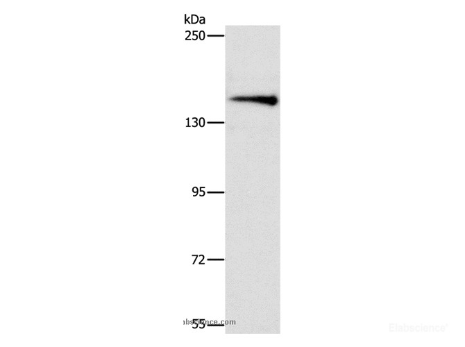 Western Blot analysis of Mouse brain tissue using ARHGEF11 Polyclonal Antibody at dilution of 1:1000