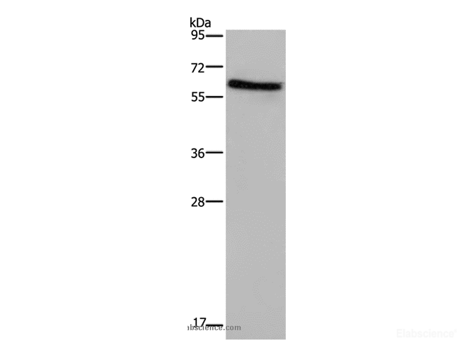 Western Blot analysis of Human placenta tissue  using CD297 Polyclonal Antibody at dilution of 1:1000