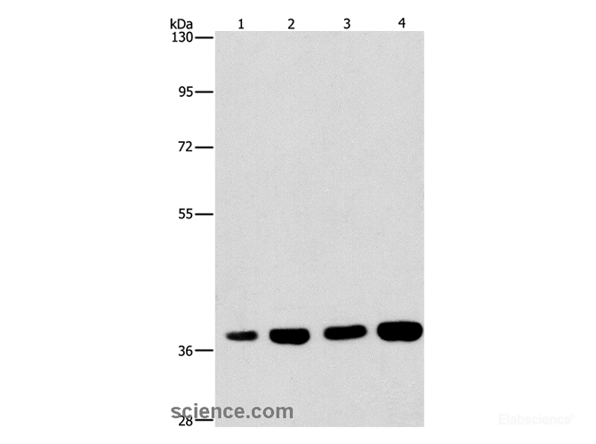 Western Blot analysis of 293T and 231 cell, U937 and Raji cell using SERPINA9 Polyclonal Antibody at dilution of 1:337.5
