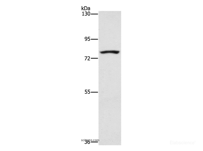 Western Blot analysis of K562 cell using SENP1 Polyclonal Antibody at dilution of 1:1500