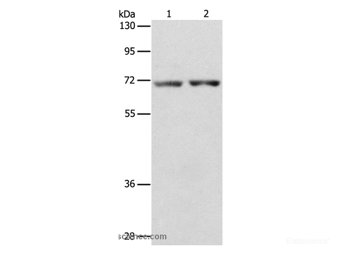 Western Blot analysis of Human liver cancer and colon cancer tissue using STK39 Polyclonal Antibody at dilution of 1:800