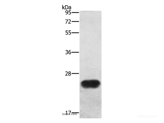 Western Blot analysis of Mouse spleen tissue using BCAS4 Polyclonal Antibody at dilution of 1:1200