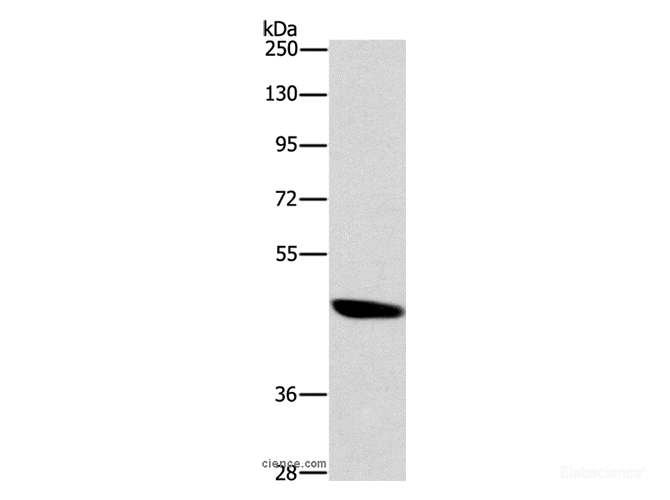 Western Blot analysis of A172 cell using BRS3 Polyclonal Antibody at dilution of 1:500