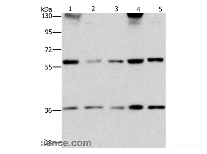 Western Blot analysis of PC3 and hela cell, Human bladder carcinoma tissue and A172 cell, hepG2 cell using STK4 Polyclonal Antibody at dilution of 1:1000