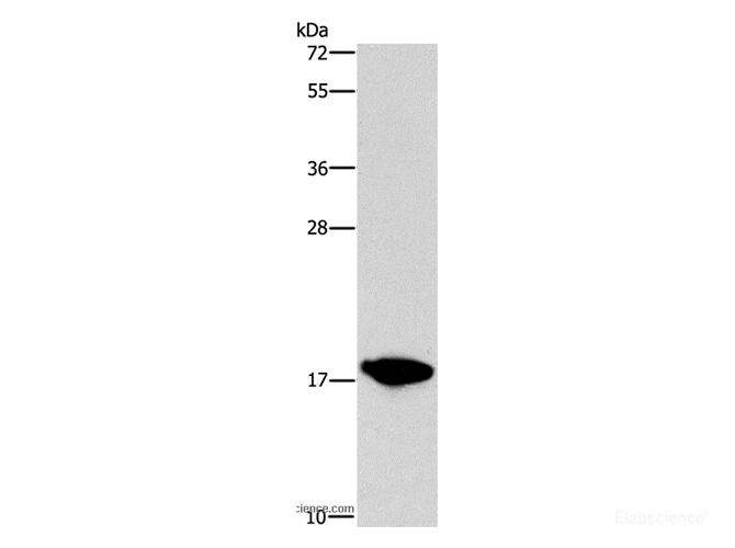Western Blot analysis of HepG2 cell using CCL16  Polyclonal Antibody at dilution of 1:760