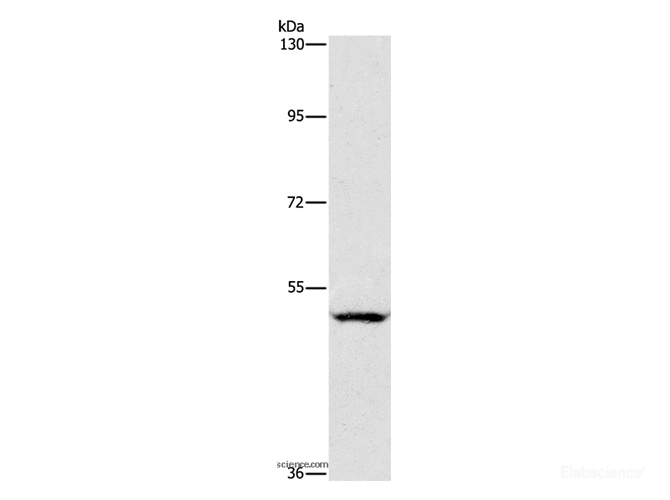 Western Blot analysis of A549 cell using CD328 Polyclonal Antibody at dilution of 1:950