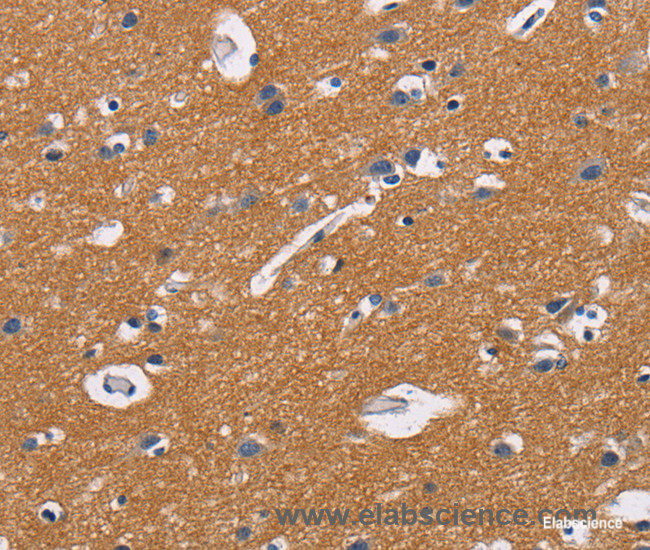 Immunohistochemistry of paraffin-embedded Human brain tissue using CD47 Polyclonal Antibody at dilution 1:50