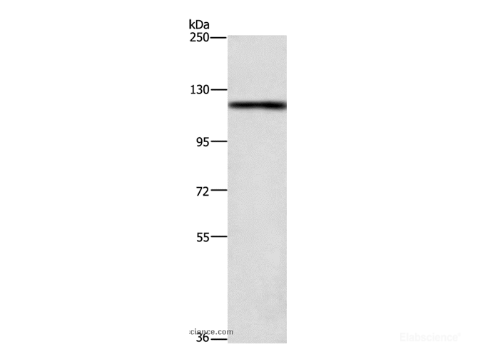 Western Blot analysis of 231 cell using TSPYL2 Polyclonal Antibody at dilution of 1:400