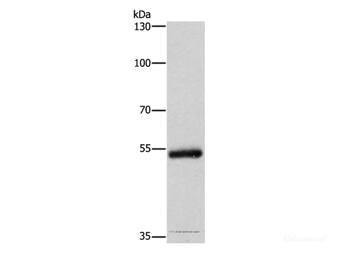 Western Blot analysis of Human colon cancer tissue using CYP2B6 Polyclonal Antibody at dilution of 1:400