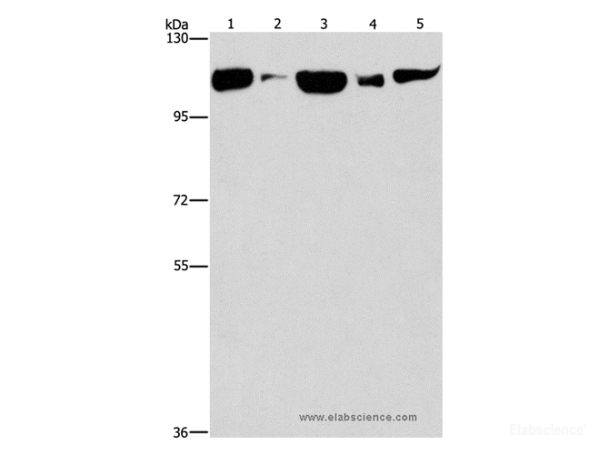Western Blot analysis of Raji cell and Human fetal liver tissue, NIH/3T3 cell and Mouse brain tissue, hela cell using DNM2 Polyclonal Antibody at dilution of 1:400