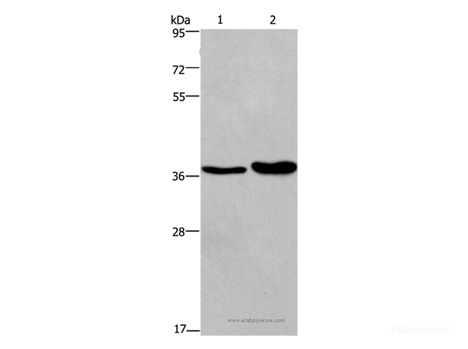 Western Blot analysis of Human testis tissue and transitional cell carcinoma of bladder tissue   using FUT1 Polyclonal Antibody at dilution of 1:250