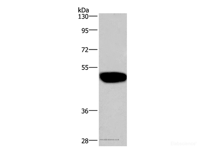 Western Blot analysis of LoVo cell using GABAA Receptor alpha1 Polyclonal Antibody at dilution of 1:300