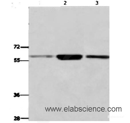 Western Blot analysis of K562,231,Human fetal liver tissue using GPC6 Polyclonal Antibody at dilution of 1:700