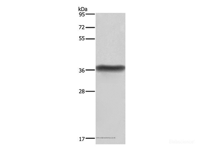 Western Blot analysis of Human placenta tissue  using HSD17B1 Polyclonal Antibody at dilution of 1:600