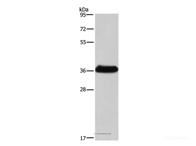 Western Blot analysis of Mouse skeletal muscle tissue   using IFNGR2 Polyclonal Antibody at dilution of 1:400