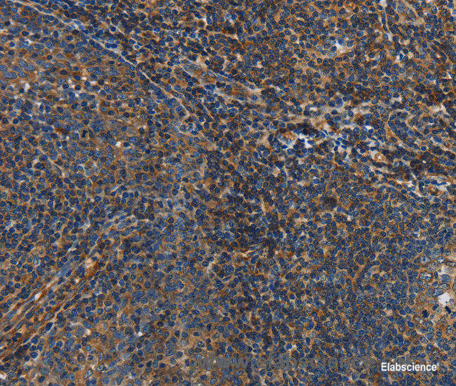 Immunohistochemistry of paraffin-embedded Human tonsil tissue using IL17D Polyclonal Antibody at dilution 1:50