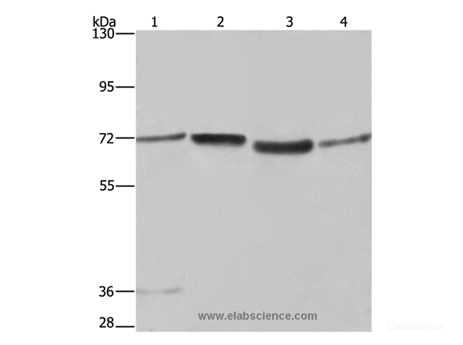 Western Blot analysis of A375 and 231 cell, 293T cell and Human hepatocellular carcinoma tissue  using SYN1 Polyclonal Antibody at dilution of 1:550