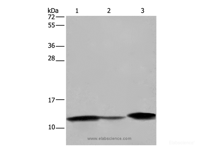 Western Blot analysis of Human fetal intestine, Mouse colon and large intestine tissue using FABP2 Polyclonal Antibody at dilution of 1:450