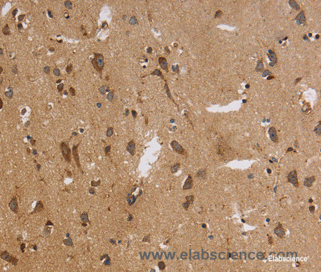 Immunohistochemistry of paraffin-embedded Human brain tissue using ITPR3 Polyclonal Antibody at dilution 1:30