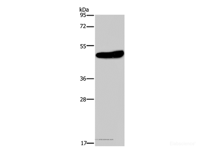 Western Blot analysis of Mouse brain tissue using KCNG2 Polyclonal Antibody at dilution of 1:650