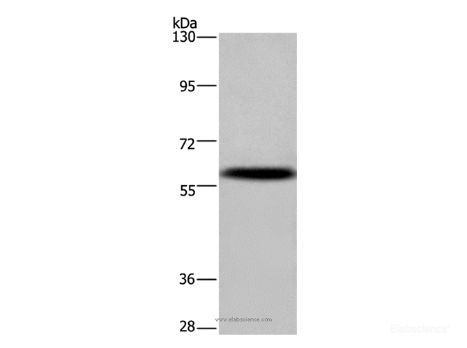 Western Blot analysis of Mouse brain tissue using KCNG4 Polyclonal Antibody at dilution of 1:500