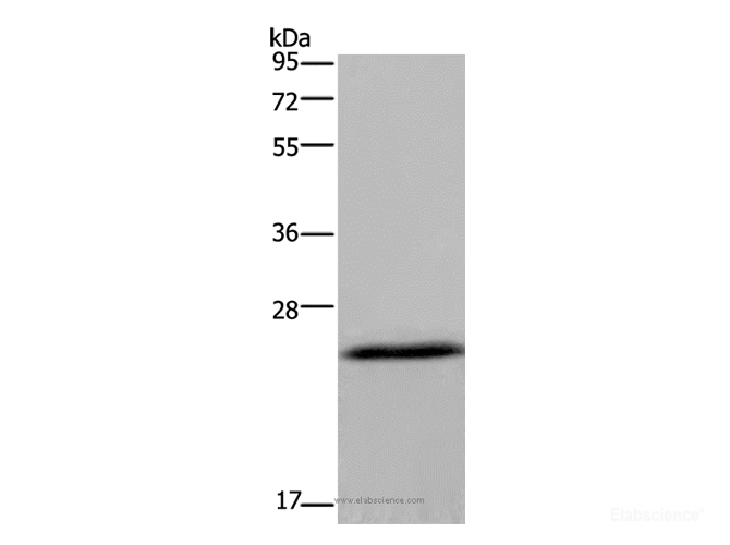 Western Blot analysis of Mouse brain tissue using KCNMB4 Polyclonal Antibody at dilution of 1:500