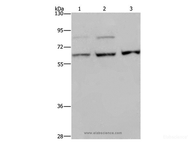 Western Blot analysis of A431, MCF-7 and Hela cell using KIF22 Polyclonal Antibody at dilution of 1:200