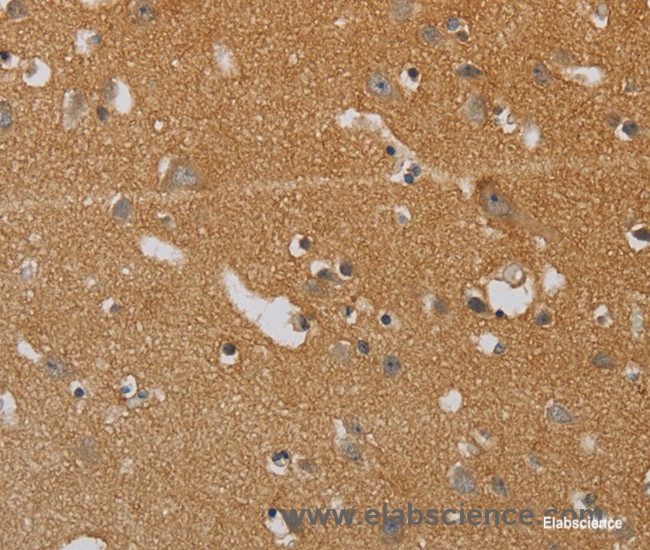 Immunohistochemistry of paraffin-embedded Human brain tissue using KIF4A Polyclonal Antibody at dilution 1:40